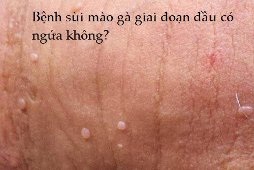 Bệnh sùi mào gà giai đoạn đầu có ngứa không?